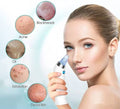 Derma Suction Pore Cleaning Device With Vacuum Action Face Pore
